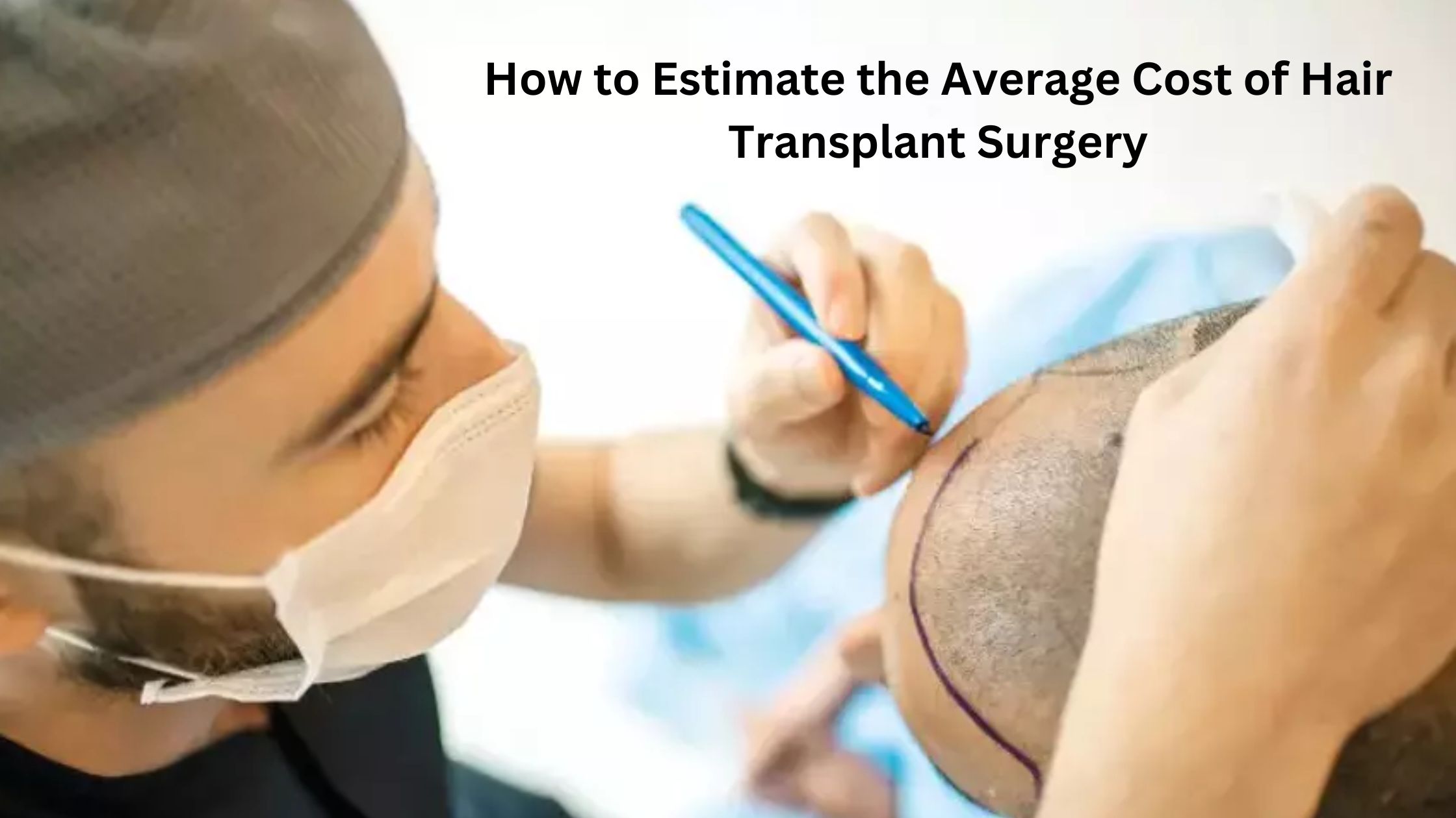 average cost of hair transplant